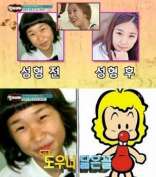 '맘마미아' 박소영, 성형 전 사진 공개…'도우너' 닮은꼴