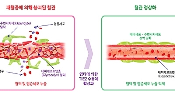 IBS “패혈증 치료 실마리 발견…생존율 70% ↑“