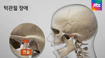 입 벌리지 못할 '턱관절 장애'…스트레스 영향 크다