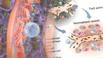 암세포 대신 암 혈관 치료…'암 잡는' 새 치료법 나왔다