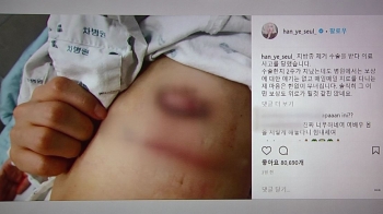 [Talk쏘는 정치] 한예슬 의료사고, 만약 일반인이었다면…