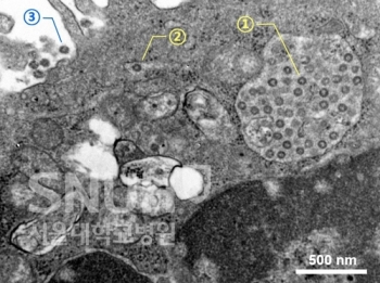 코로나19 현미경사진 국내 첫 공개…“바이러스에 변이 추정“