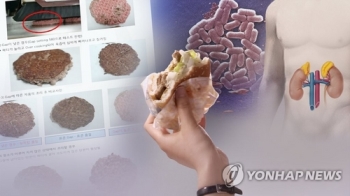 '햄버거병' 피하려면…“충분히 익혀 먹고 주방 기구는 청결히“