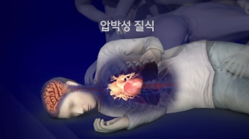 우르르 인파 겹겹이…“3m 포개지면 300㎏ 넘는 압박“