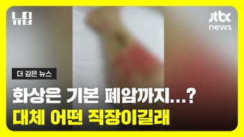 [뉴딥] 화상은 기본, 폐암까지…도대체 어떤 직장이길래