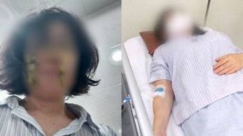 아동학대 진실게임된 '기저귀 사건'…봉변 교사 '불안증' 입원