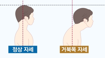 '당신의 자세는 안녕하십니까' 거북목 자가진단부터 마사지 방법까지｜송영민 소장 [상클 라이프]