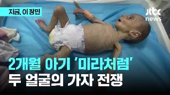 2개월 된 가자 아기 '미라처럼'…“배고파 울 힘도 없다“