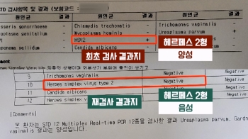 [사반 제보]'양성→음성' 일주일새 바뀐 성병 검사...“이혼할 뻔“