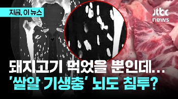 쌀알 모양 돼지고기 '기생충'…근육에만? 뇌에도 침투