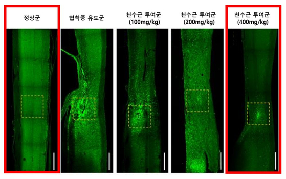 실리콘 이식 부위에 집중됐던 염증 관련 대식세포가 천수근 투입 농도에 비례해 감소했다. 〈사진=자생한방병원 제공〉