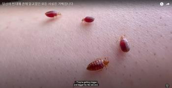 커지는 '빈대 공포증'…“퇴치? 이대로만 하세요“