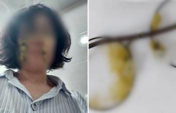 똥기저귀 보육교사에 던진 학부모의 결말…결국 재판 넘겨져