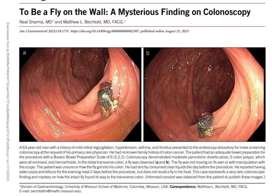 미국소화기학회지(American Journal of Gastroenterology 최근호에 게재된 대장에서 발견된 파리의 사진. 날개와 다리, 몸통 등이 온전한 상태로 대장벽에 붙은 채 발견됐다 〈사진=미국소화기학회지〉