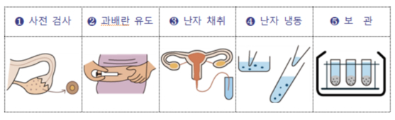 난자 동결 과정 〈사진=서울시〉