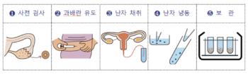 서울시, 20대 난자동결 시술비 지원 확대...“건강한 동결 지원“