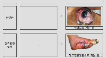 담뱃갑 경고 그림, 더 독해진다...“심장마비로 가는 길“