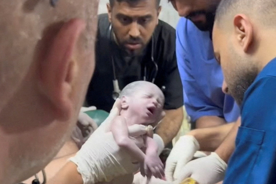 현지시간 20일 밤 가자 남부 라파에서 이스라엘의 공습으로 숨진 임신부의 배 속에 있던 아기가 응급 제왕절개 수술을 통해 태어난 모습. 〈사진=로이터〉