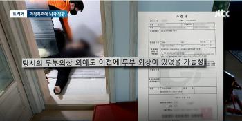 뇌출혈로 쓰러진 아내 두고 테니스 친 남편 “폭행 주장 사실아냐“